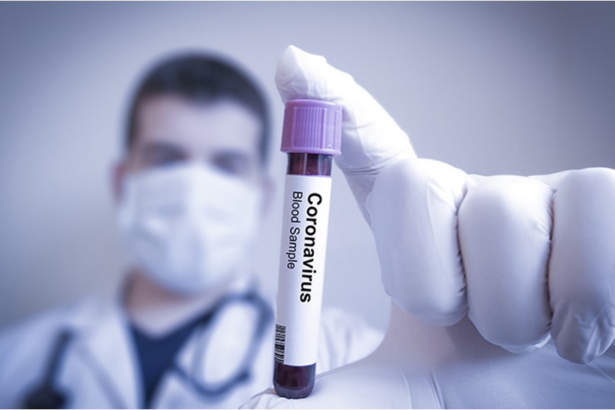 CORONAVIRUS (2019-NCOV): MYTHS AND FACTS